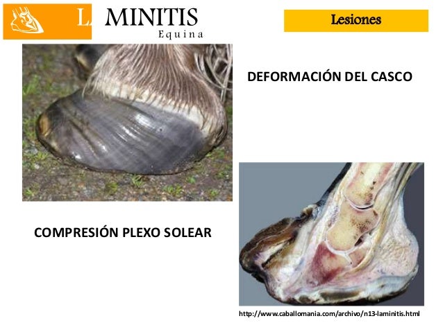 Laminitis equina
