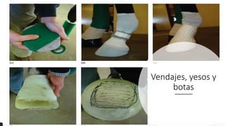Vendajes, yesos y
botas
 