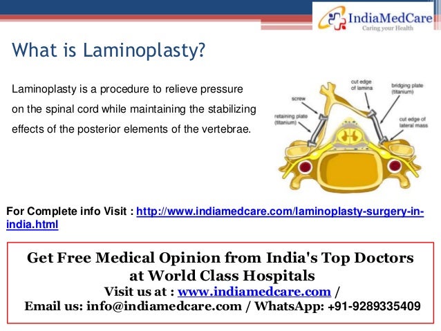 Laminoplasty at Spine Surgery Hospitals in India Laminoplasty at Spine Surgery Hospitals in India