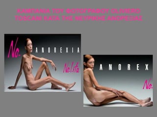 ΚΑΜΠΑΝΙΑ ΤΟΥ ΦΩΤΟΓΡΑΦΟΥ OLIVIERO
TOSCANI ΚΑΤΑ ΤΗΣ ΝΕΥΡΙΚΗΣ ΑΝΟΡΕΞΙΑΣ
 