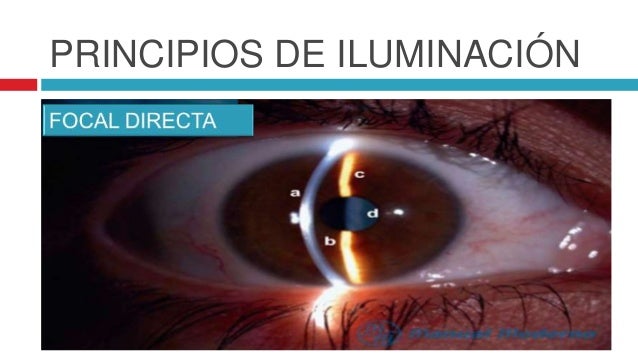 Lampara de hendidura