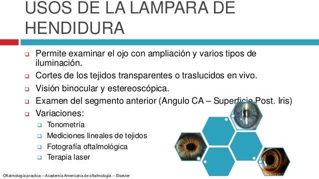 Lampara de hendidura