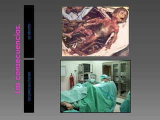 Las consecuencias.el abortolas precauciones