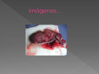            imágenes…