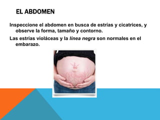 EL ABDOMEN
Inspeccione el abdomen en busca de estrías y cicatrices, y
observe la forma, tamaño y contorno.
Las estrías violáceas y la línea negra son normales en el
embarazo.
 