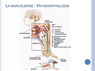 LA NARCOLEPSIE : PHYSIOPATHOLOGIE
 