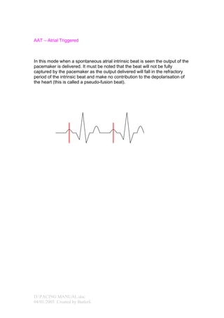 Lancashire_and_South_Cumbria_Cardiac_physiologist_training_pacing ...