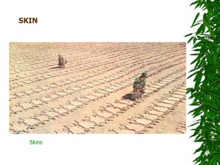 SKIN




  Skins
 