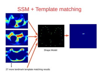 SSM + Template matching 
... 
Shape Model 
27 more landmark template matching results 
 