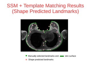 SSM + Template Matching Results 
(Shape Predicted Landmarks) 
Manually selected landmarks and skin surface 
Shape predicted landmarks 
 