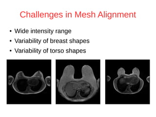 Challenges in Mesh Alignment 
● Wide intensity range 
● Variability of breast shapes 
● Variability of torso shapes 
 
