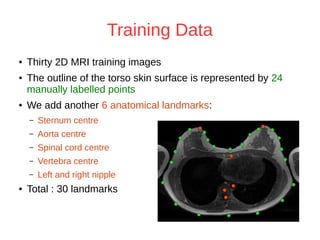 Landmark detection using statistical shape modelling and template ...