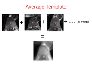Average Template 
+ + + 
= 
…..(30 images) 
 