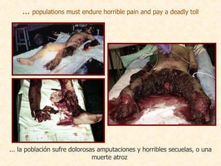 ...  populations must endure horrible pain and pay a deadly toll ... la población sufre dolorosas amputaciones y horribles secuelas, o una muerte atroz   