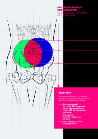 MA VIE DE SPONDY
PAR NOVARTIS
COMMUNIQUER AU-DELÀ
DE LA MALADIE
À travers le dispositif “Ma vie
de Spondy”, Novartis développe
une vision globale de la spondylarthrite
ankylosante et ses effets, en associant
la parole de professionnels de santé
à celle d’associations de patients
dans une démarche coopérative,
toujours au service du patient.
CIBLES
Patients atteints de spondylarthrite
ankylosante et leurs proches
PARTIES PRENANTES
Associations de patients,
professionnels de santé
ACTIONS
DE COMMUNICATION
Une page Facebook dédiée
à l’échange entre patients :
ligne éditoriale inclusive,
autour de la vie quotidienne.
Une journée événementielle
“Ma vie de Spondy” en partenariat
avec des associations
de patients (ateliers ludiques, etc).
Une stratégie performante : Un “marketing
relationnel” et une tonalité juste, qui reconnaît
l’expertise des associations de patients
Une communauté
de + de 12 000 personnes,
autour d’une maladie qui
touche 180 000 personnes
en France.
Une moyenne
de 500 engagements
par post.
Une confiance recréée
avec les publics.
RÉSULTATS
 