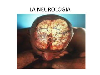 LA NEUROLOGIA 