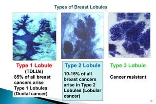 Types of Breast Lobules




Type 1 Lobule           Type 2 Lobule         Type 3 Lobule
    (TDLUs)             10-15% of ...
