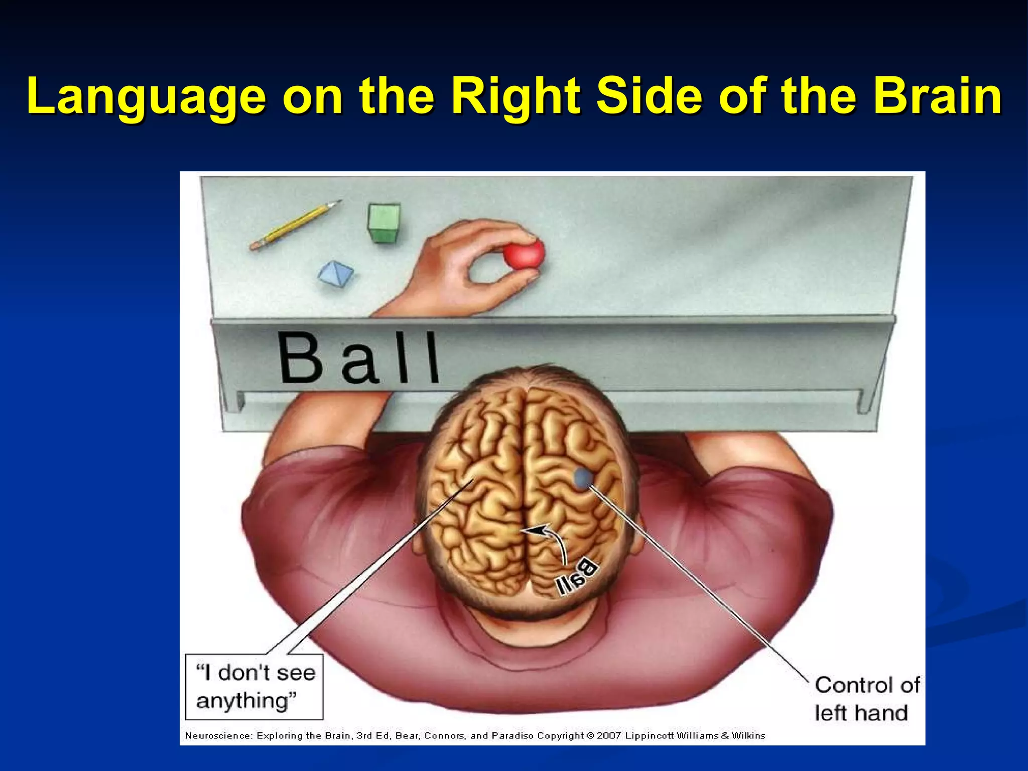 Language on the Right Side of the Brain 