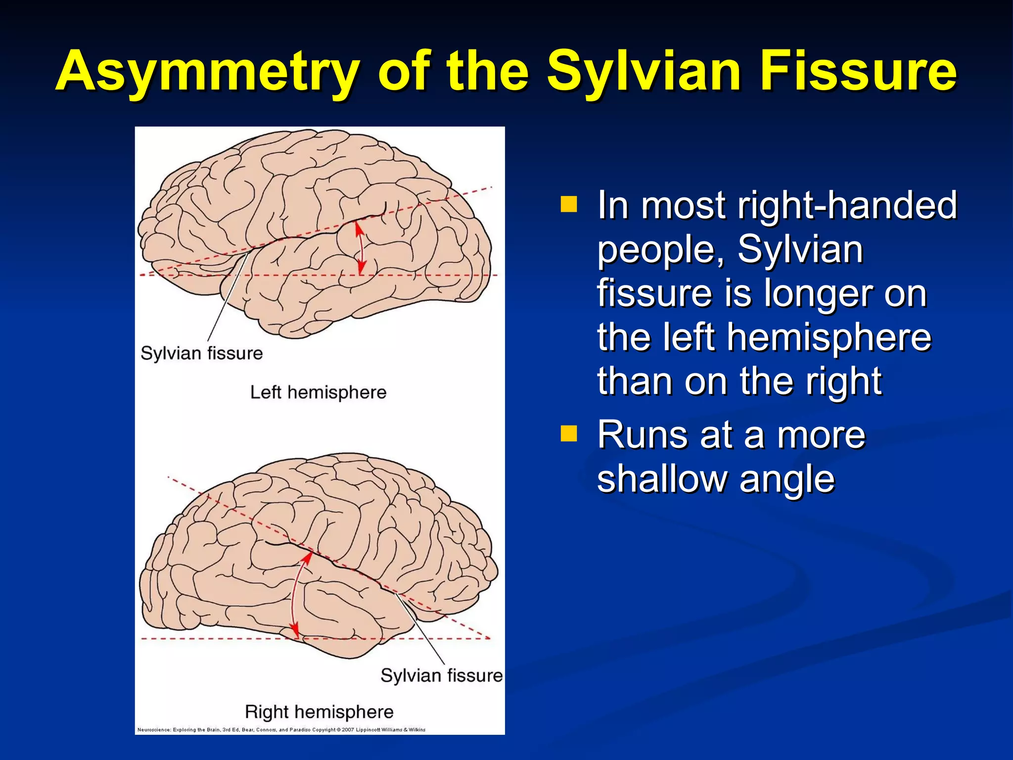 Asymmetry of the Sylvian Fissure In most right-handed people, Sylvian fissure is longer on the left hemisphere than on the right Runs at a more shallow angle 