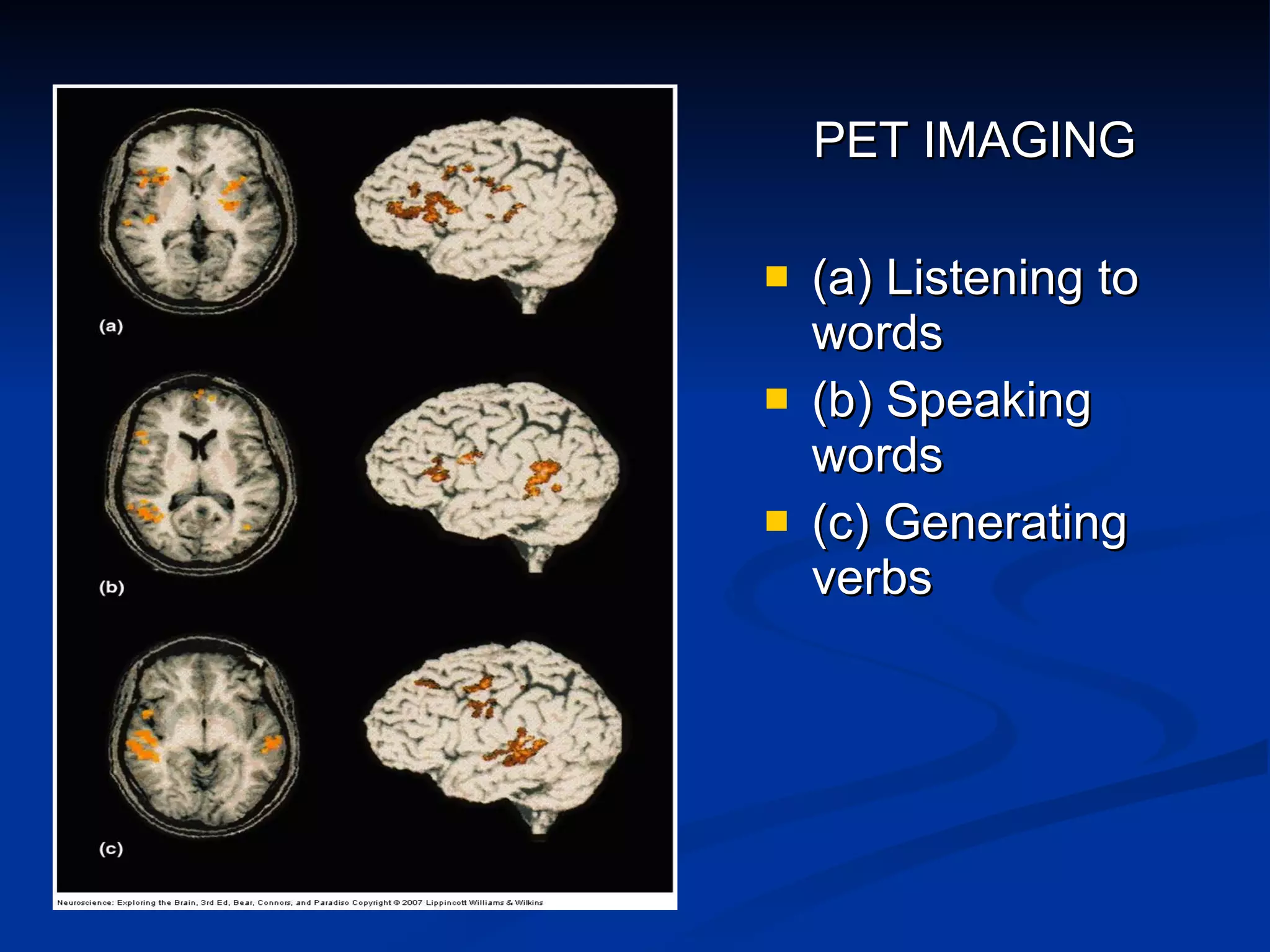 PET IMAGING (a) Listening to words (b) Speaking words (c) Generating verbs 