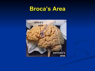 Broca’s Area 