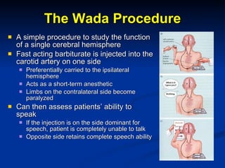 The Wada Procedure A simple procedure to study the function of a single cerebral hemisphere Fast acting barbiturate is injected into the carotid artery on one side Preferentially carried to the ipsilateral hemisphere Acts as a short-term anesthetic Limbs on the contralateral side become paralyzed Can then assess patients’ ability to speak If the injection is on the side dominant for speech, patient is completely unable to talk Opposite side retains complete speech ability 