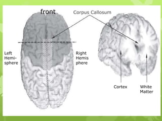 front Corpus Callosum
Left
Hemi-
sphere
Right
Hemis
phere
Cortex White
Matter
 