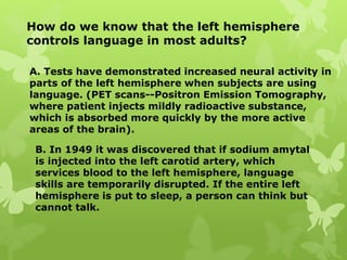 How do we know that the left hemisphere
controls language in most adults?
A. Tests have demonstrated increased neural activity in
parts of the left hemisphere when subjects are using
language. (PET scans--Positron Emission Tomography,
where patient injects mildly radioactive substance,
which is absorbed more quickly by the more active
areas of the brain).
B. In 1949 it was discovered that if sodium amytal
is injected into the left carotid artery, which
services blood to the left hemisphere, language
skills are temporarily disrupted. If the entire left
hemisphere is put to sleep, a person can think but
cannot talk.
 
