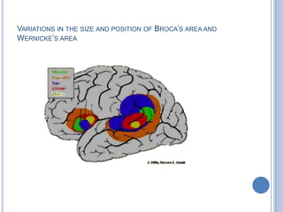 The first responds to spoken words (including the individual’s own) and other sounds. 