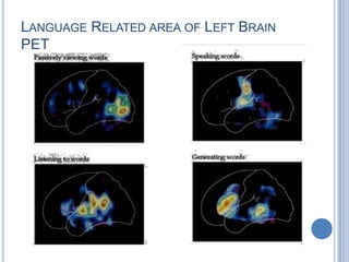 From Wernicke's area, information travels to Broca's area, then to the Primary Motor Cortex to produce the utteranceWernicke - Geshwind model: Reading aloudTo speak a word that is read, information must first get to the primary visual cortex. From the primary visual cortex, information is transmitted to the posterior speech area, including Wernicke's area (via the angular gyrus, which mediates between visual and auditory aspects of language). From Wernicke's area, information travels to Broca's area, then to the Primary Motor Cortex.Variations in the size and position of Broca’s area and Wernicke’s area