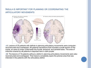  Hearing a word primary unimodel auditory cortex superior and anterior temporal lobe 