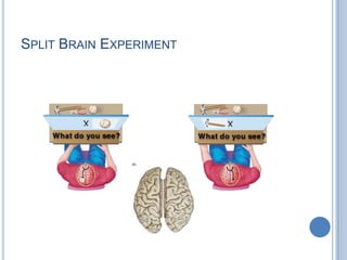 The triangular and orbital portions of the inferior frontal gyrus also play a role in semantic processing.