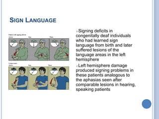 Geschwind’s territorythe inferior parietal lobule is connected by large bundles of nerve fibres to both Broca’s area and Wernicke’s area. 