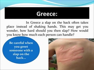 Greece:
In Greece a slap on the back often takes
place instead of shaking hands. This may get you
wonder, how hard should you then slap? How would
you know how much each person can handle?
Be careful when
you greet
someone with a
slap on the
back...
 