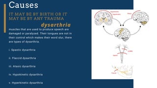 Causes
IT MAY BE BY BIRTH OR IT
MAY BE BY ANY TRAUMA
muscles that are used to produce speech are
damaged or paralyzed. Their tongues are not in
their control which makes their word slur, there
are types of dysarthria.
i. Spastic dysarthria
ii. Flaccid dysarthria
iii. Ataxic dysarthria
iv. Hypokinetic dysarthria
v. Hyperkinetic dysarthria
dysarthria
 