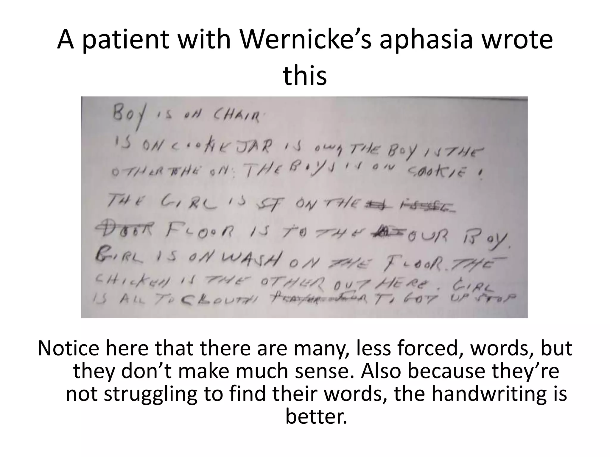 A patient with Wernicke’s aphasia wrote
this
Notice here that there are many, less forced, words, but
they don’t make much sense. Also because they’re
not struggling to find their words, the handwriting is
better.
 