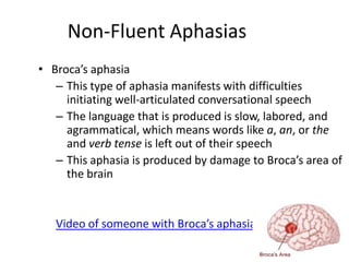 Non-Fluent Aphasias
• Broca’s aphasia
– This type of aphasia manifests with difficulties
initiating well-articulated conversational speech
– The language that is produced is slow, labored, and
agrammatical, which means words like a, an, or the
and verb tense is left out of their speech
– This aphasia is produced by damage to Broca’s area of
the brain
Video of someone with Broca’s aphasia
 