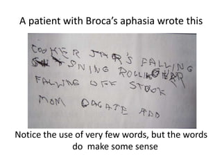 A patient with Broca’s aphasia wrote this
Notice the use of very few words, but the words
do make some sense
 