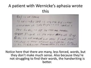 A patient with Wernicke’s aphasia wrote
this
Notice here that there are many, less forced, words, but
they don’t make much sense. Also because they’re
not struggling to find their words, the handwriting is
better.
 