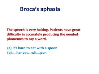 The speech is very halting. Patients have great
difficulty in accurately producing the needed
phonemes to say a word.
(a) It's hard to eat with a spoon
(b)…. har eat….wit….pun
Broca’s aphasia
 