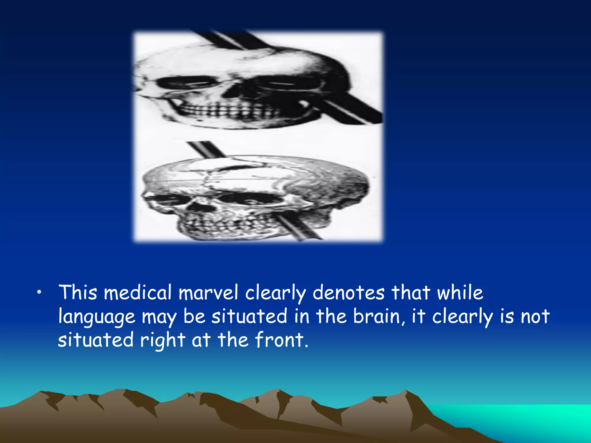• This medical marvel clearly denotes that while
language may be situated in the brain, it clearly is not
situated right at the front.
 