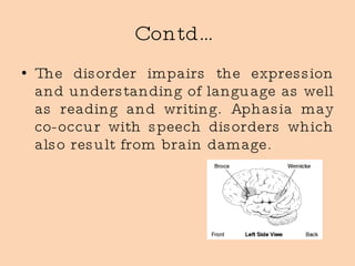 Contd… The disorder impairs the expression and understanding of language as well as reading and writing. Aphasia may co-occur with speech disorders which also result from brain damage.  