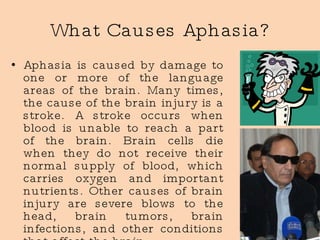 What Causes Aphasia? Aphasia is caused by damage to one or more of the language areas of the brain. Many times, the cause of the brain injury is a stroke. A stroke occurs when blood is unable to reach a part of the brain. Brain cells die when they do not receive their normal supply of blood, which carries oxygen and important nutrients. Other causes of brain injury are severe blows to the head, brain tumors, brain infections, and other conditions that affect the brain. 