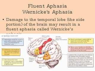 Fluent Aphasia Wernicke's Aphasia Damage to the temporal lobe (the side portion) of the brain may result in a fluent aphasia called Wernicke’s aphasia.   
