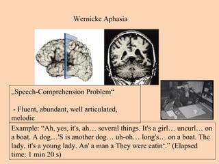 Wernicke Aphasia „ Speech-Comprehension Problem“ -  Fluent, abundant, well articulated, melodic Example: “Ah, yes, it's, ah… several things. It's a girl… uncurl… on a boat. A dog…'S is another dog… uh-oh… long's… on a boat. The lady, it's a young lady. An' a man a They were eatin‘.” (Elapsed time: 1 min 20 s) 