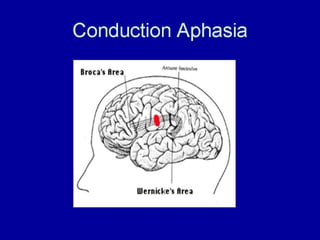 Language disorders | PPT