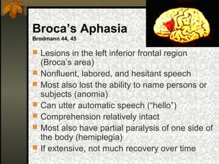 Broca’s Aphasia
Brodmann 44, 45
 Lesions in the left inferior frontal region
(Broca’s area)
 Nonfluent, labored, and hesitant speech
 Most also lost the ability to name persons or
subjects (anomia)
 Can utter automatic speech (“hello”)
 Comprehension relatively intact
 Most also have partial paralysis of one side of
the body (hemiplegia)
 If extensive, not much recovery over time
 