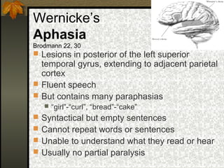 Wernicke’s
Aphasia
Brodmann 22, 30
 Lesions in posterior of the left superior
temporal gyrus, extending to adjacent parietal
cortex
 Fluent speech
 But contains many paraphasias
 “girl”-“curl”, “bread”-“cake”
 Syntactical but empty sentences
 Cannot repeat words or sentences
 Unable to understand what they read or hear
 Usually no partial paralysis
 