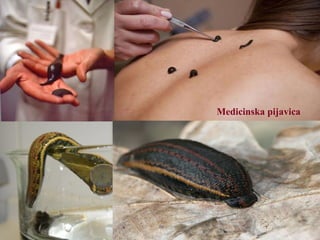 Medicinska pijavica
 