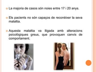  La majoria de casos són noies entre 17 i 20 anys.
 Els pacients no són capaços de reconèixer la seva
malaltia.
 Aquesta malaltia va lligada amb alteracions
psicològiques greus, que provoquen canvis de
comportament.
 